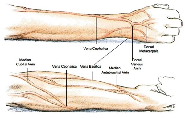 Периферичні венозні катетери: встановлення та догляд за місцем введення Периферичні венозні катетери: встановлення та догляд за місцем введення