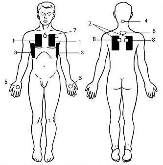 Проведення процедур за допомогою медичних апаратів при хронічному бронхіті застосування медичних апаратів
