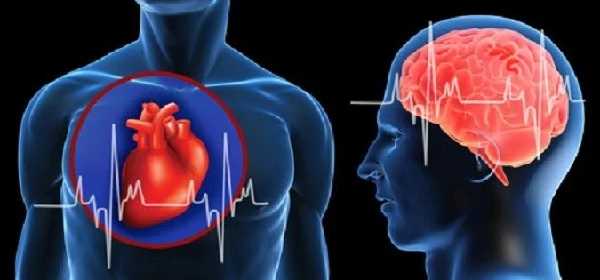 Експерти НСЗУ обговорили умови закупівлі послуг за напрямами меддопомоги під час інфарктів та інсультів Експерти НСЗУ обговорили умови закупівлі послуг за напрямами меддопомоги під час інфарктів та інсультів